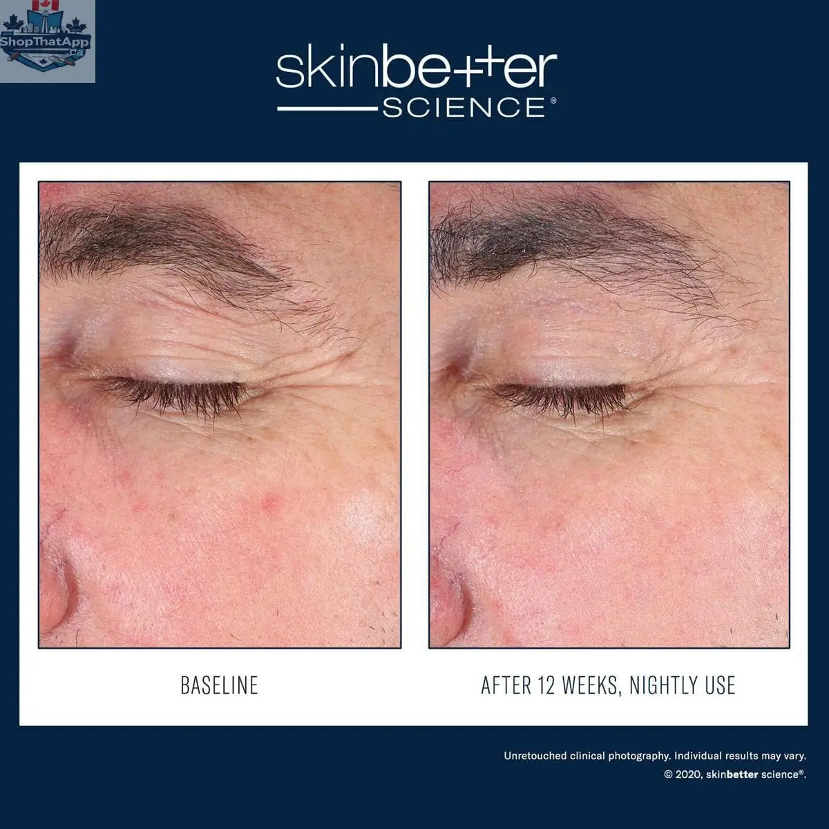 Skinbetter Science EyeMax AlphaRet Overnight eye treatment jar with silver lid and sleek packaging, designed for advanced eye skin care.