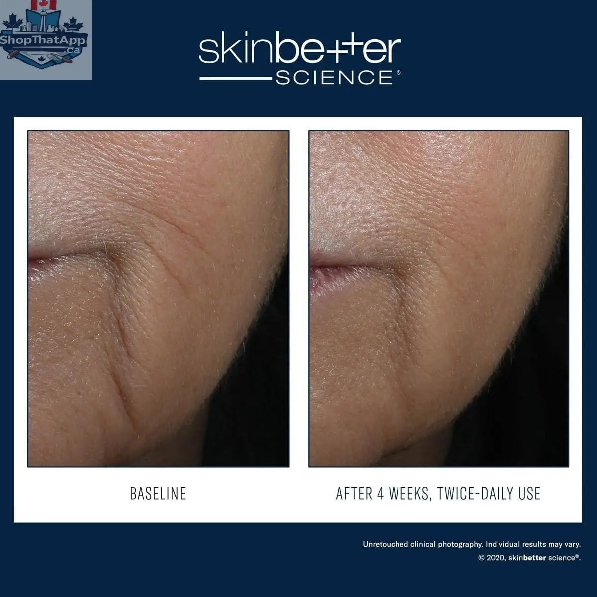Skinbetter Science Interfuse Treatment for anti-aging showing the product bottle and applicator against a neutral background.