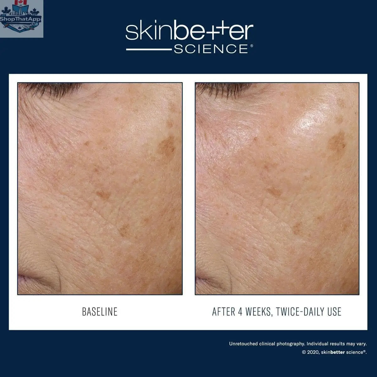 Skinbetter Science Moisture Treatment Trio showing three bottles of Rebalancing Moisture Treatment for skin hydration.