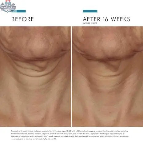SkinCeuticals Tripeptide-R Neck Repair cream in a jar, designed for youthful skin, with a smooth cream texture and labeled packaging.