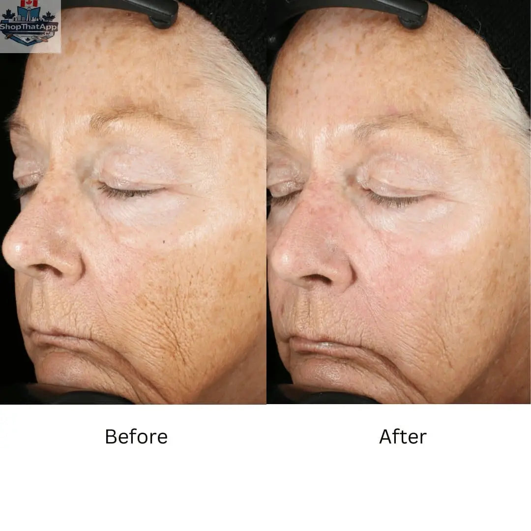 Travel-size ZO Wrinkle Repair by Monarch MD, a retinol skin brightener for radiant, youthful skin and texture improvement.