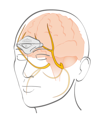 CEFALY® Electrodes--www.Shopthatapp.ca-BHR Biosynex