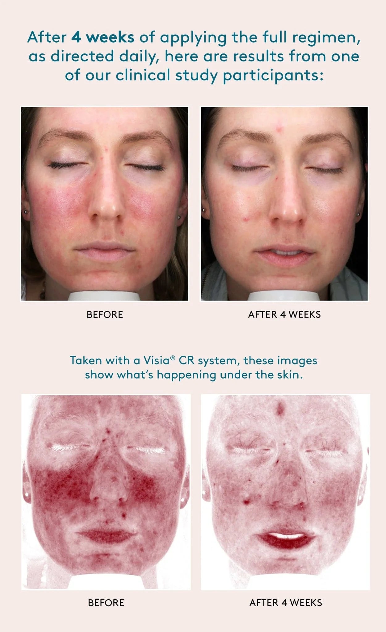 Colorescience All Calm Clinical Redness Corrector SPF 50 - Shopthatapp.ca
