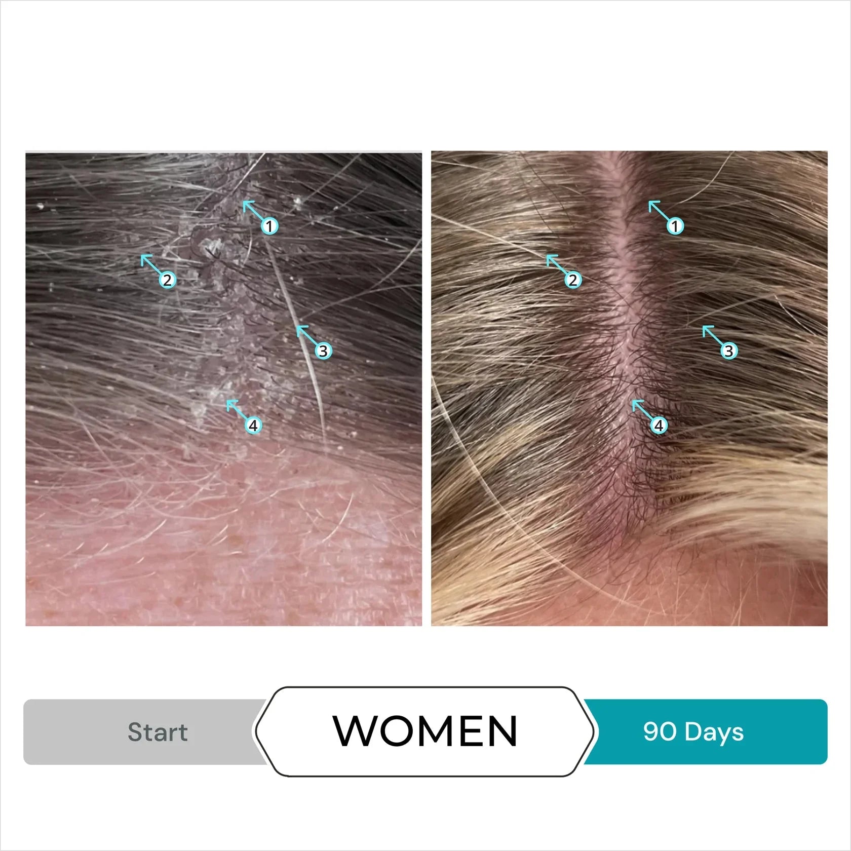 Dandrene Anti-Dandruff Conditioner - Shopthatapp.ca