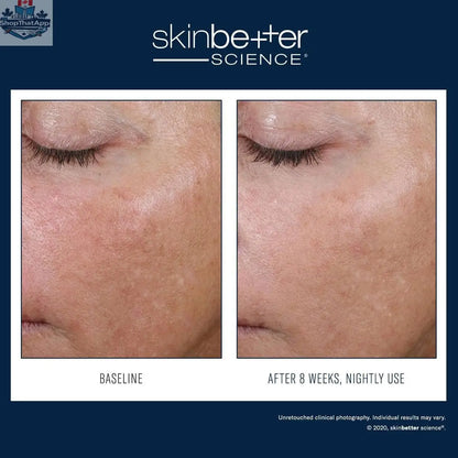 Skinbetter Science AlphaRet Overnight Cream jar with white and gold packaging for youthful skin renewal.