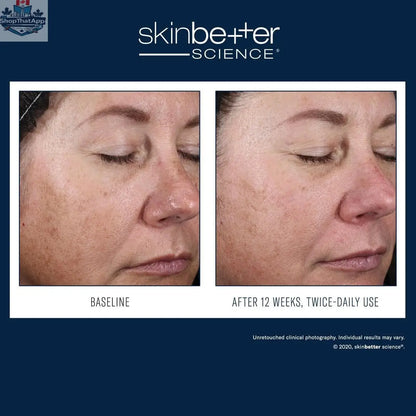 Skinbetter Science Alto Advanced Defense and Repair skincare product for improved skin health, displayed in a sleek bottle.
