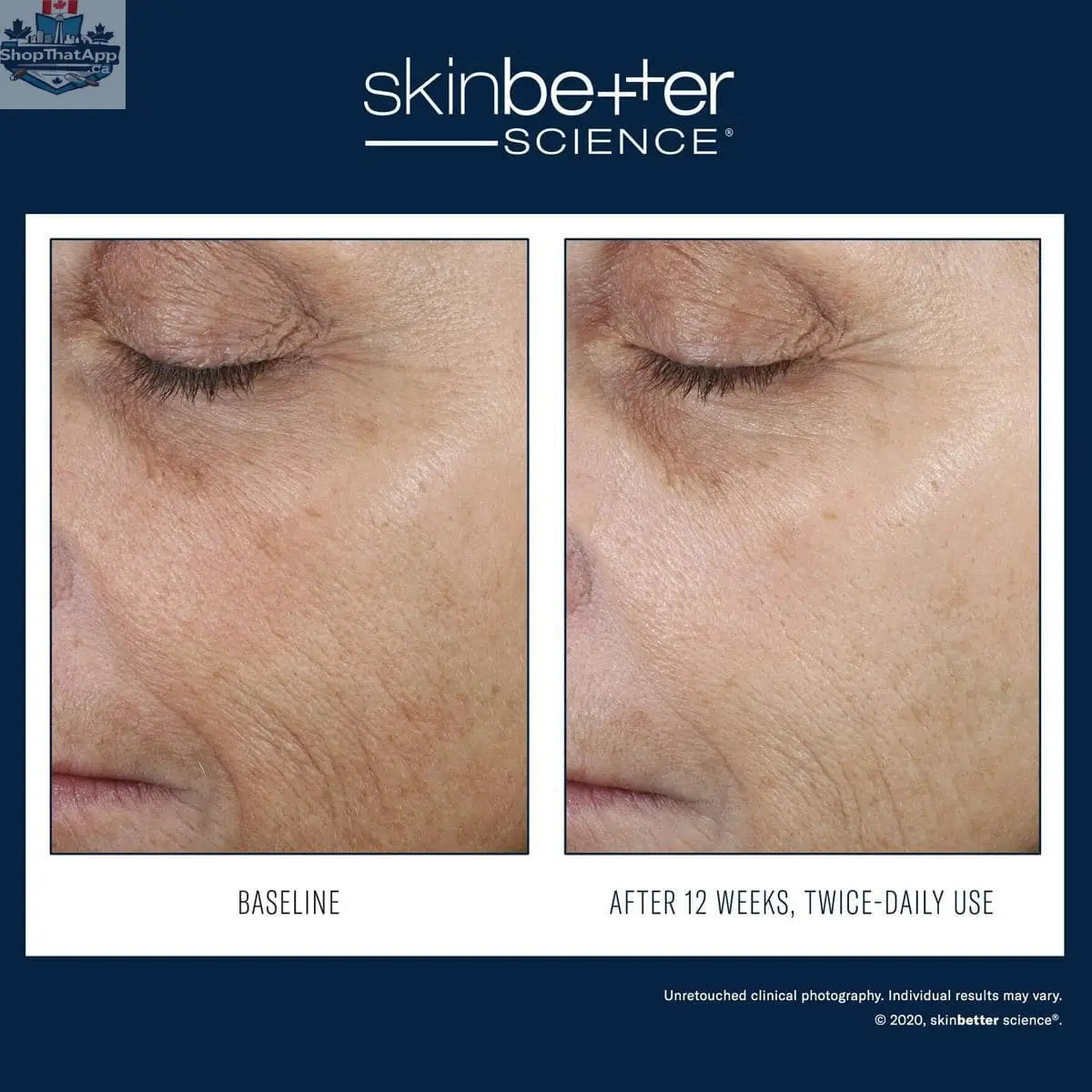 Skinbetter Science Even Intensive Correcting Serum for radiant skin, shown in a sleek bottle with a dropper applicator.