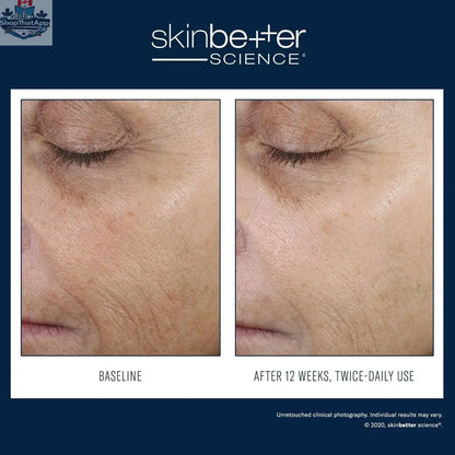 Skinbetter Science Even Intensive Correcting Serum for radiant skin, shown in a sleek bottle with a dropper applicator.
