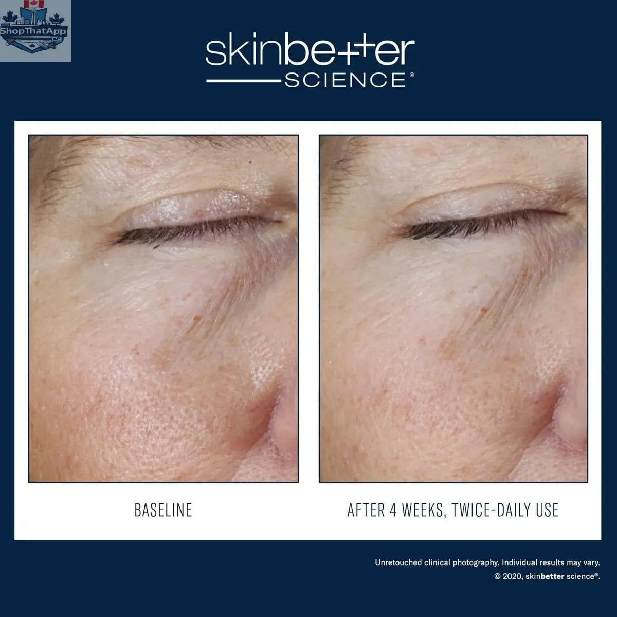 Skinbetter Science Eye Gel by Monarch MD Medical Aesthetics, featuring clear gel in a sleek tube for youthful eye appearance.