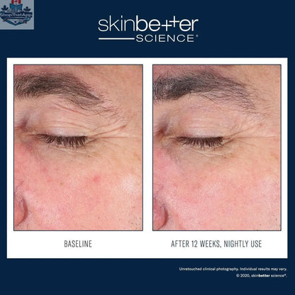 Skinbetter Science EyeMax AlphaRet Overnight eye treatment jar with silver lid and sleek packaging, designed for advanced eye skin care.