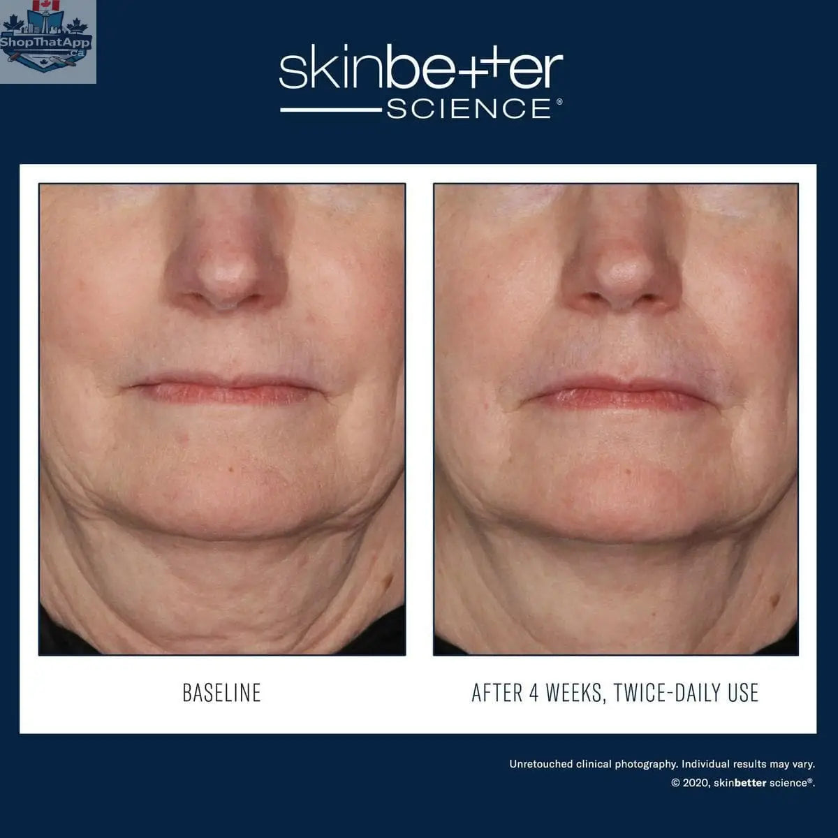 Skinbetter Science Interfuse Treatment Cream for face and neck, featuring advanced hydration and rejuvenation benefits.