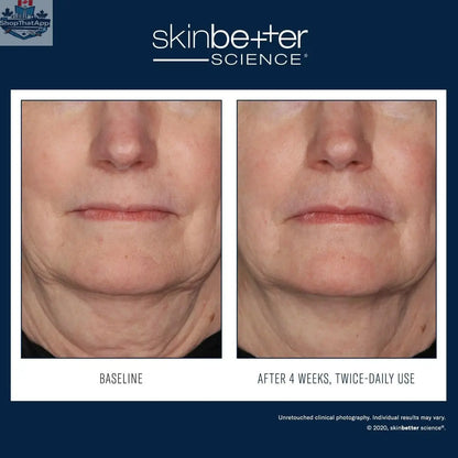 Skinbetter Science Interfuse Treatment Cream for face and neck, featuring advanced hydration and rejuvenation benefits.