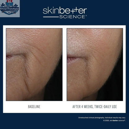 Skinbetter Science Interfuse Treatment for anti-aging showing the product bottle and applicator against a neutral background.
