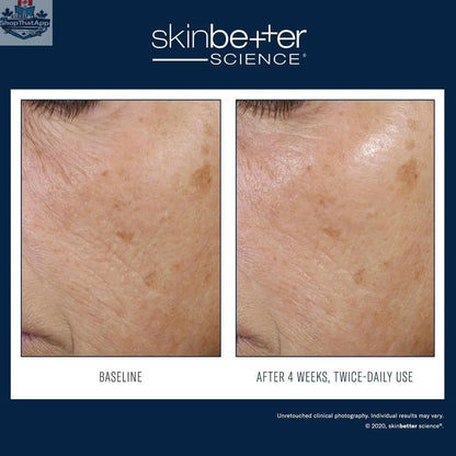 Skinbetter Science Moisture Treatment Trio showing three bottles of Rebalancing Moisture Treatment for skin hydration.