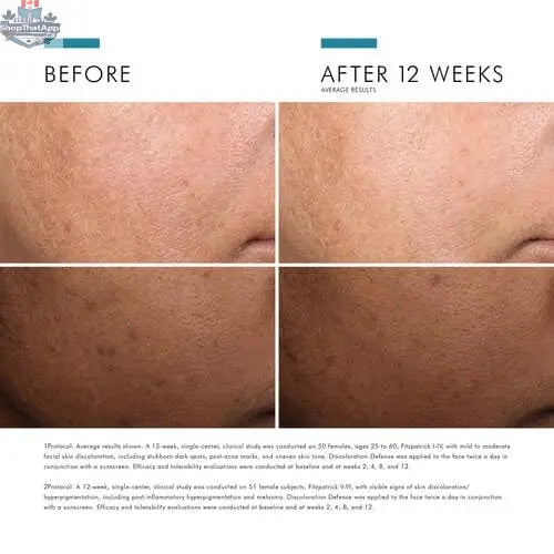 SkinCeuticals Discoloration Defense serum bottle for even skin tone and brightened complexion, displayed on a clean background.