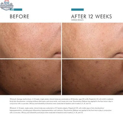 SkinCeuticals Discoloration Defense serum bottle for even skin tone and brightened complexion, displayed on a clean background.
