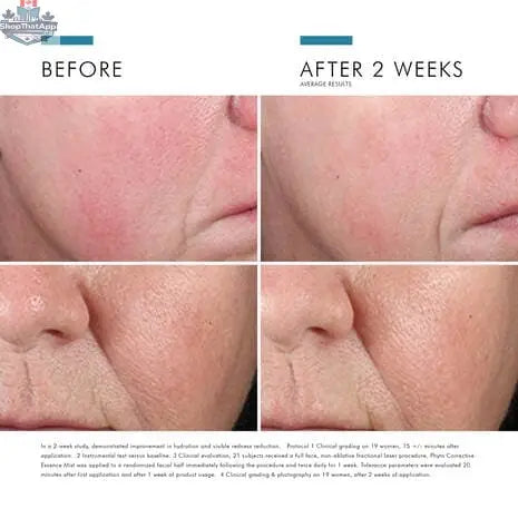SkinCeuticals Phyto Corrective Mist for soothing hydration and radiant skin, in a clear spray bottle with a misting nozzle.