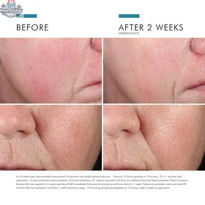 SkinCeuticals Phyto Corrective Mist for soothing hydration and radiant skin, in a clear spray bottle with a misting nozzle.