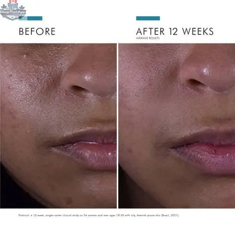 SkinCeuticals Silymarin CF serum bottle with dropper, featuring antioxidant protection and oil control for healthy skin.