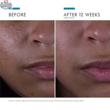 SkinCeuticals Silymarin CF serum bottle with dropper, featuring antioxidant protection and oil control for healthy skin.
