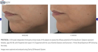 Zo Firming Serum by Monarch MD Medical Aesthetics shown in a sleek bottle with a pump dispenser on a white background.