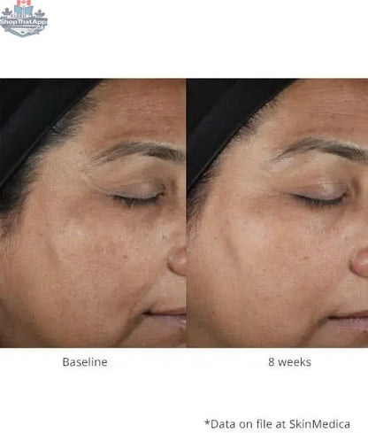 SkinMedica Lumivive System Day and Night skincare set with bottles for radiant skin, displayed on a clean surface.