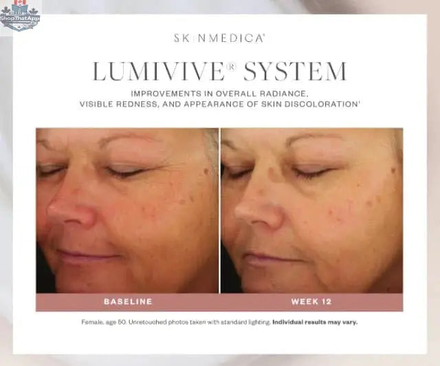 SkinMedica Lumivive System Day and Night skincare set for radiant skin, displayed in sleek bottles on a clean background.