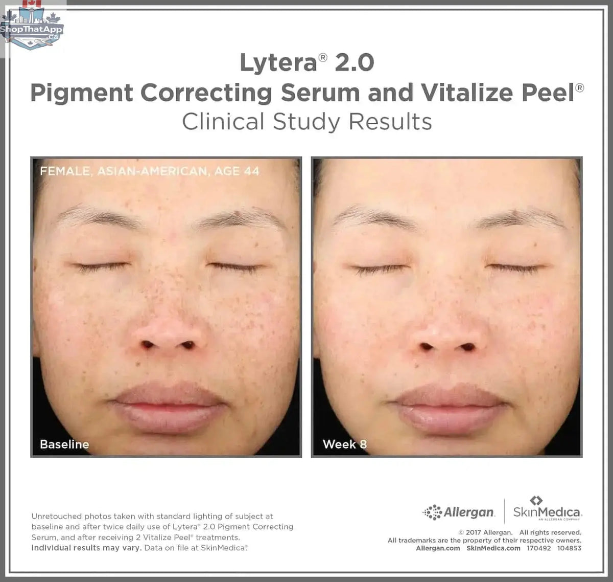 SkinMedica Lytera 2.0 Brightening Serum in a sleek bottle, designed to improve skin tone and brighten the complexion.