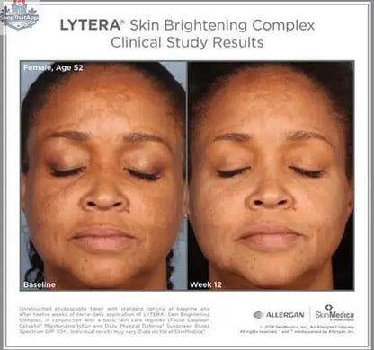 SkinMedica Lytera 2.0 Brightening Serum for even skin tone, shown in a sleek skincare bottle with a pump dispenser.