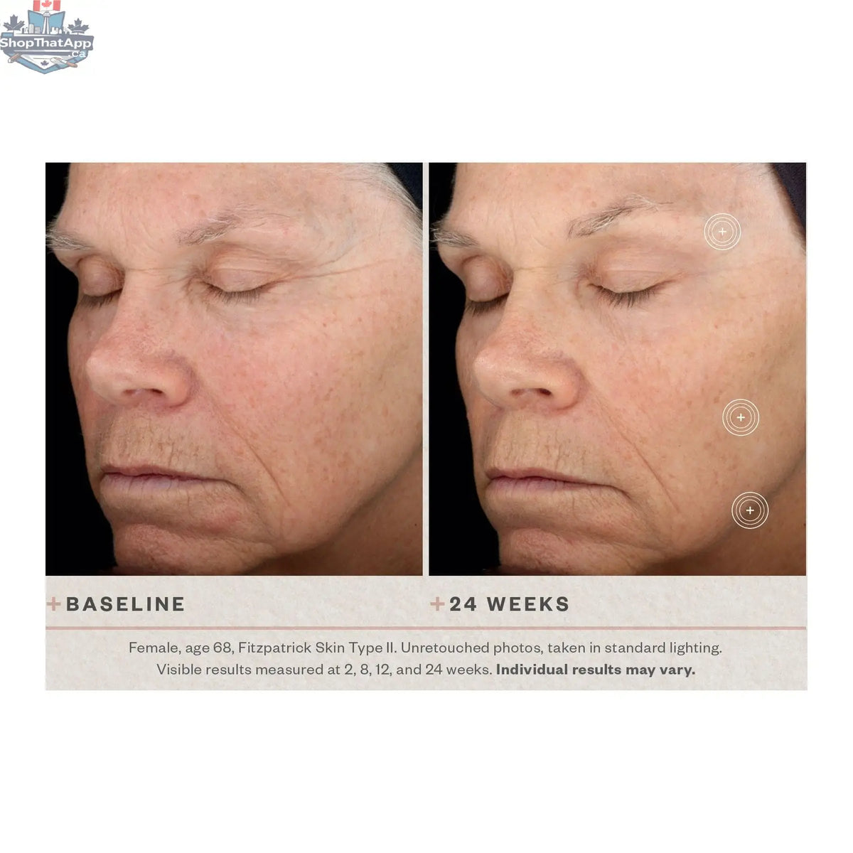 SkinMedica TNS Advanced+ Serum in a clear dropper bottle, part of Skin Care products for skin rejuvenation.