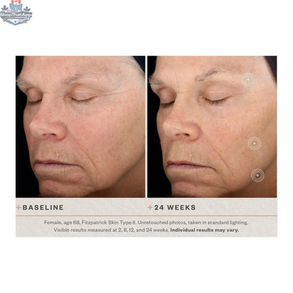 SkinMedica TNS Advanced+ Serum in a clear dropper bottle, part of Skin Care products for skin rejuvenation.