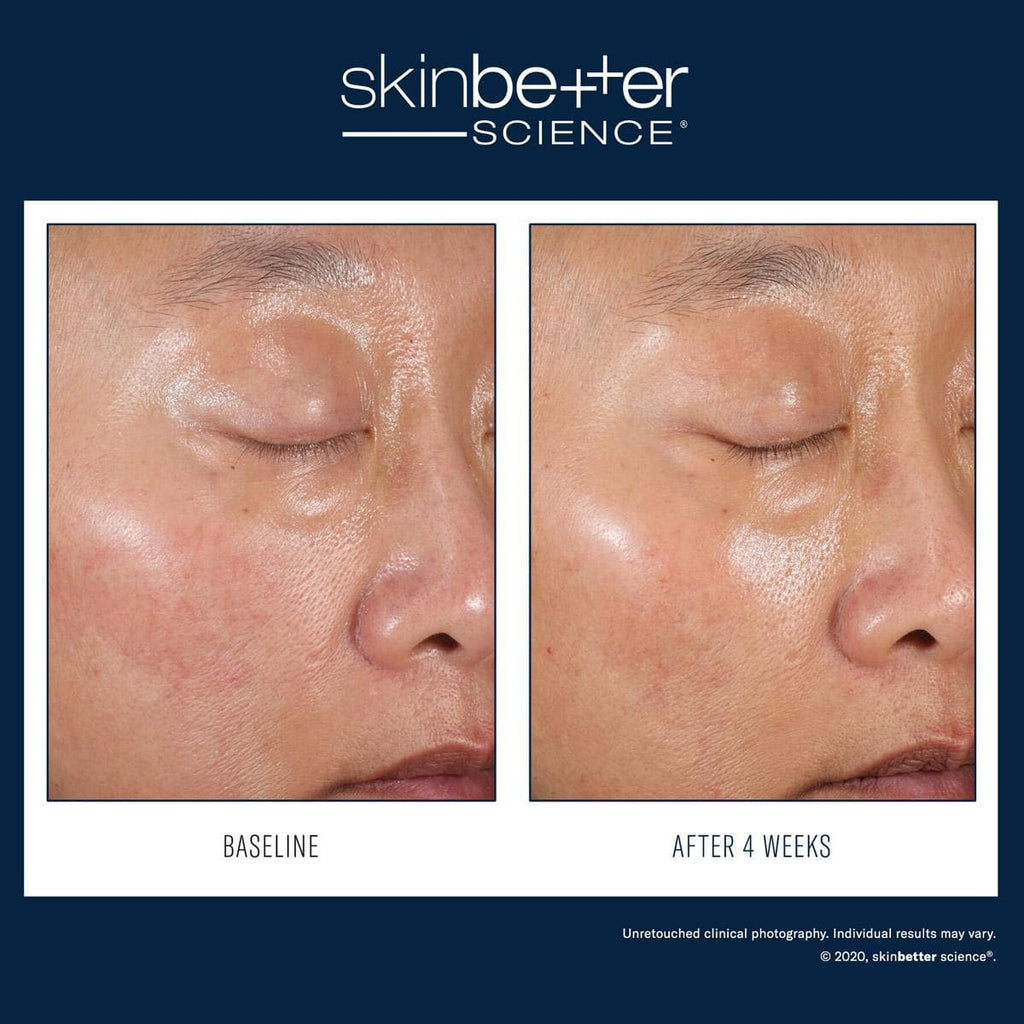 SkinBetter Science - A-Team Duo Kit - Shopthatapp.ca