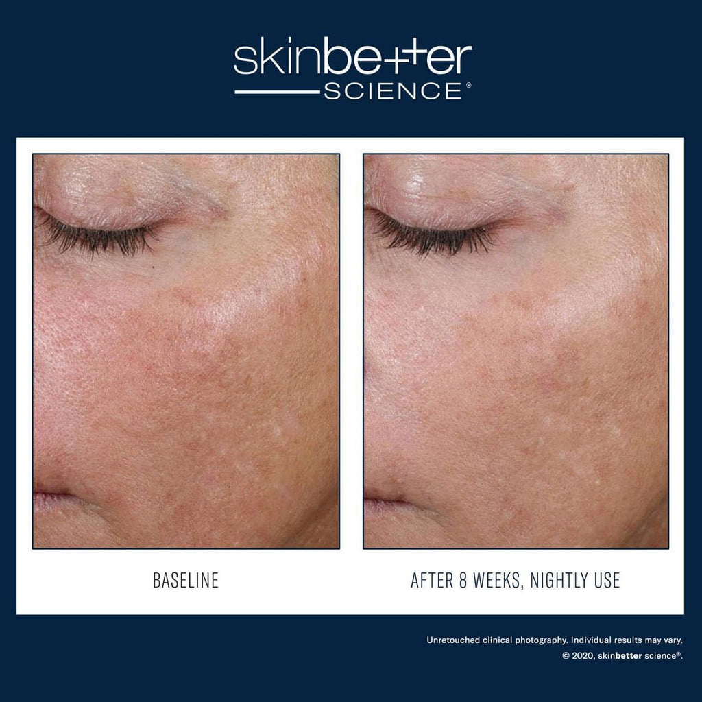 Skinbetter Science - AlphaRet Overnight Cream - Shopthatapp.ca