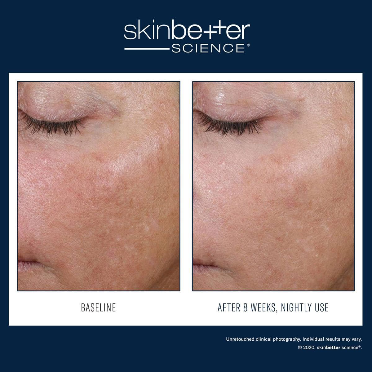 Skinbetter Science - AlphaRet Overnight Cream - Shopthatapp.ca