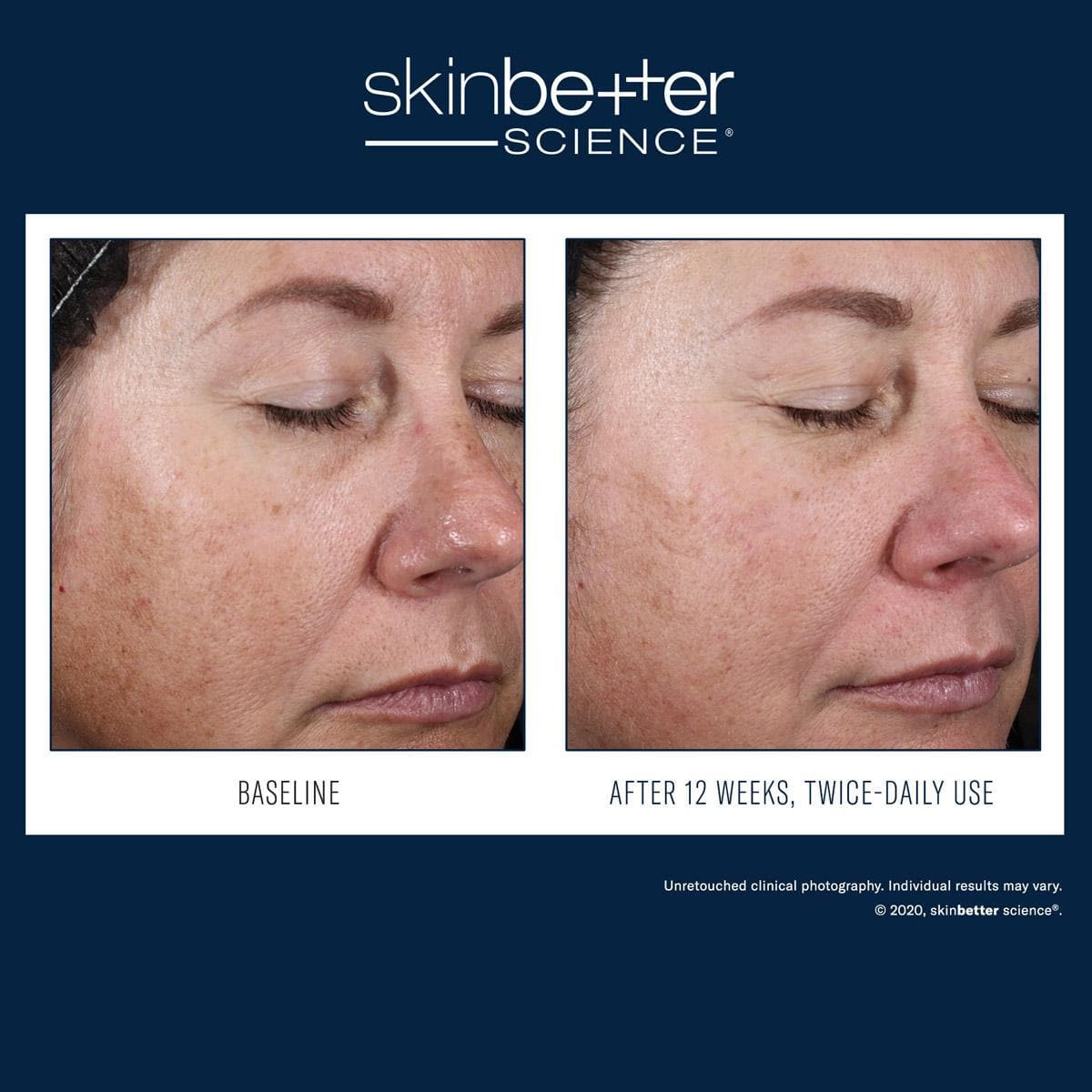 Skinbetter Science - Alto Advanced Defense and Repair - Shopthatapp.ca