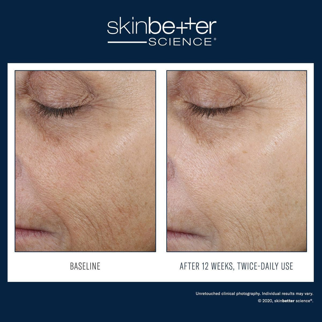 Skinbetter Science - Even Intensive Correcting Serum Face - Shopthatapp.ca