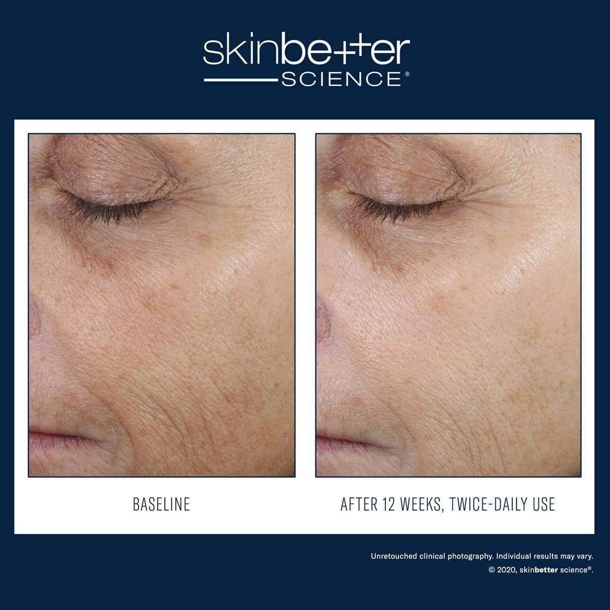 Skinbetter Science - Even Intensive Correcting Serum Face - Shopthatapp.ca