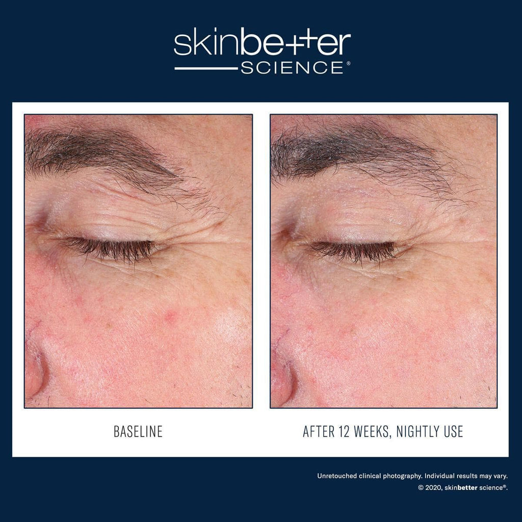 Skinbetter Science - EyeMax AlphaRet Overnight - Shopthatapp.ca