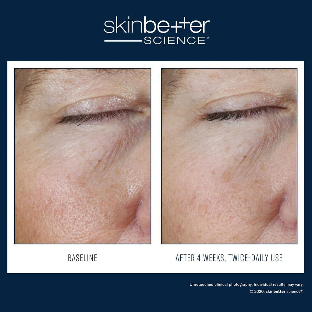 Skinbetter Science - Instant Effect Eye Gel - Shopthatapp.ca