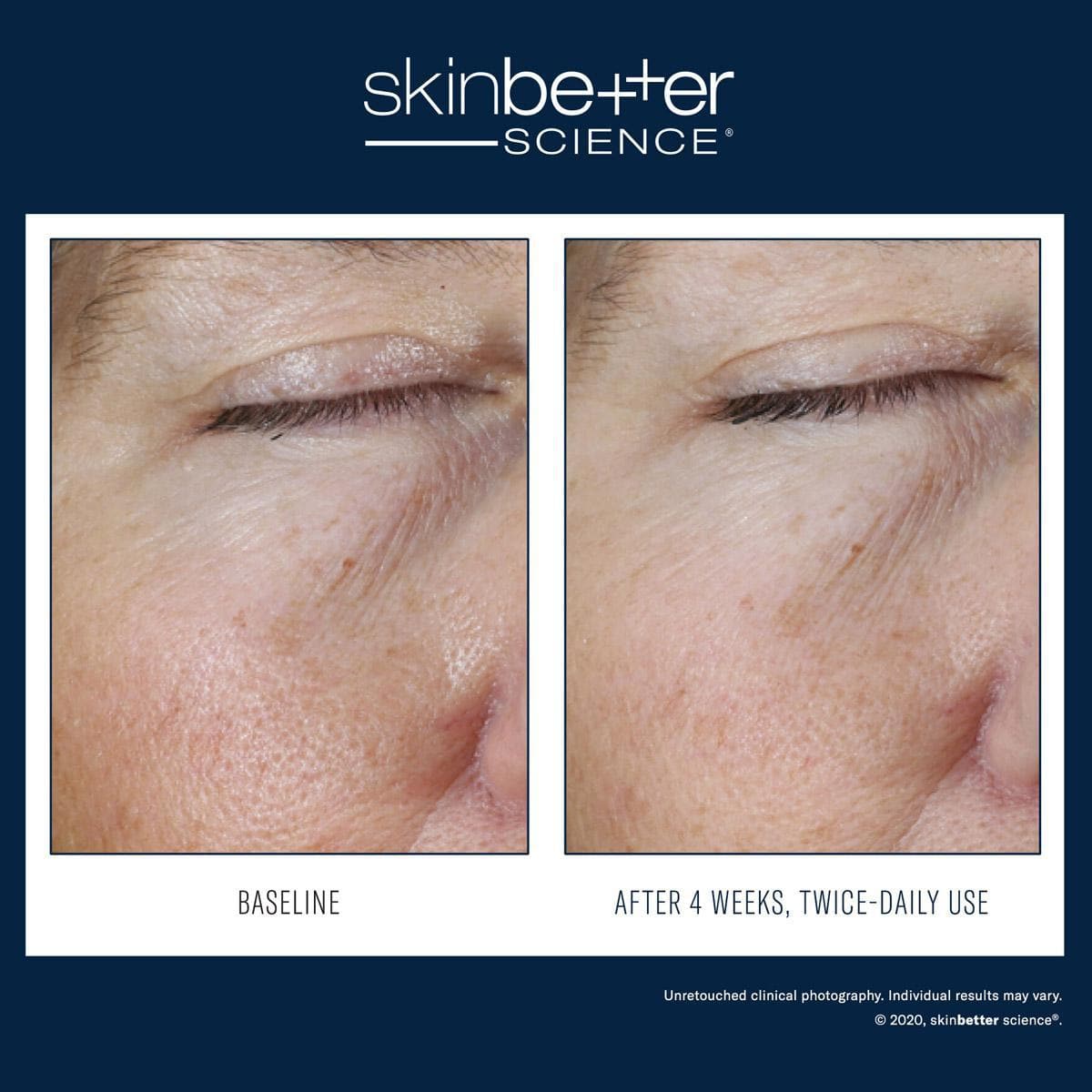 Skinbetter Science - Instant Effect Eye Gel - Shopthatapp.ca