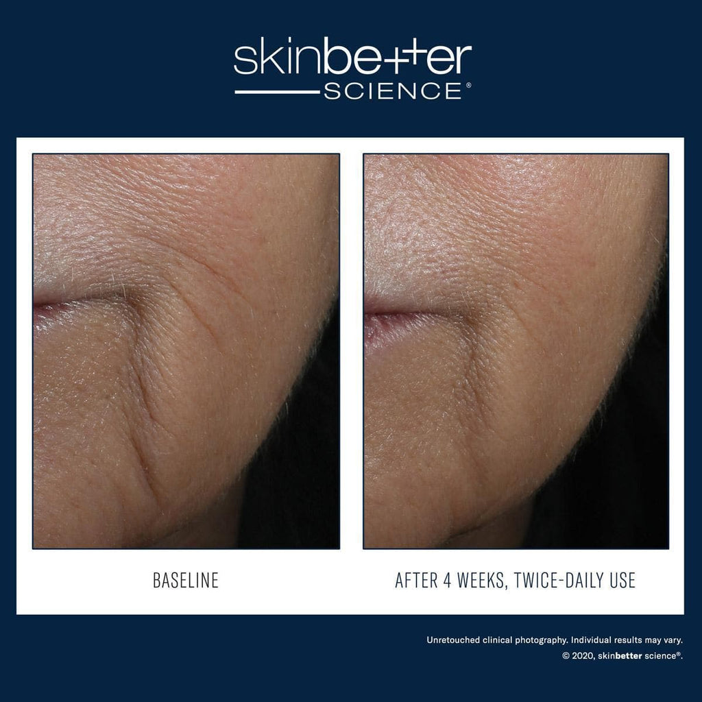 Skinbetter Science - Interfuse Intensive Treatment Lines - Shopthatapp.ca