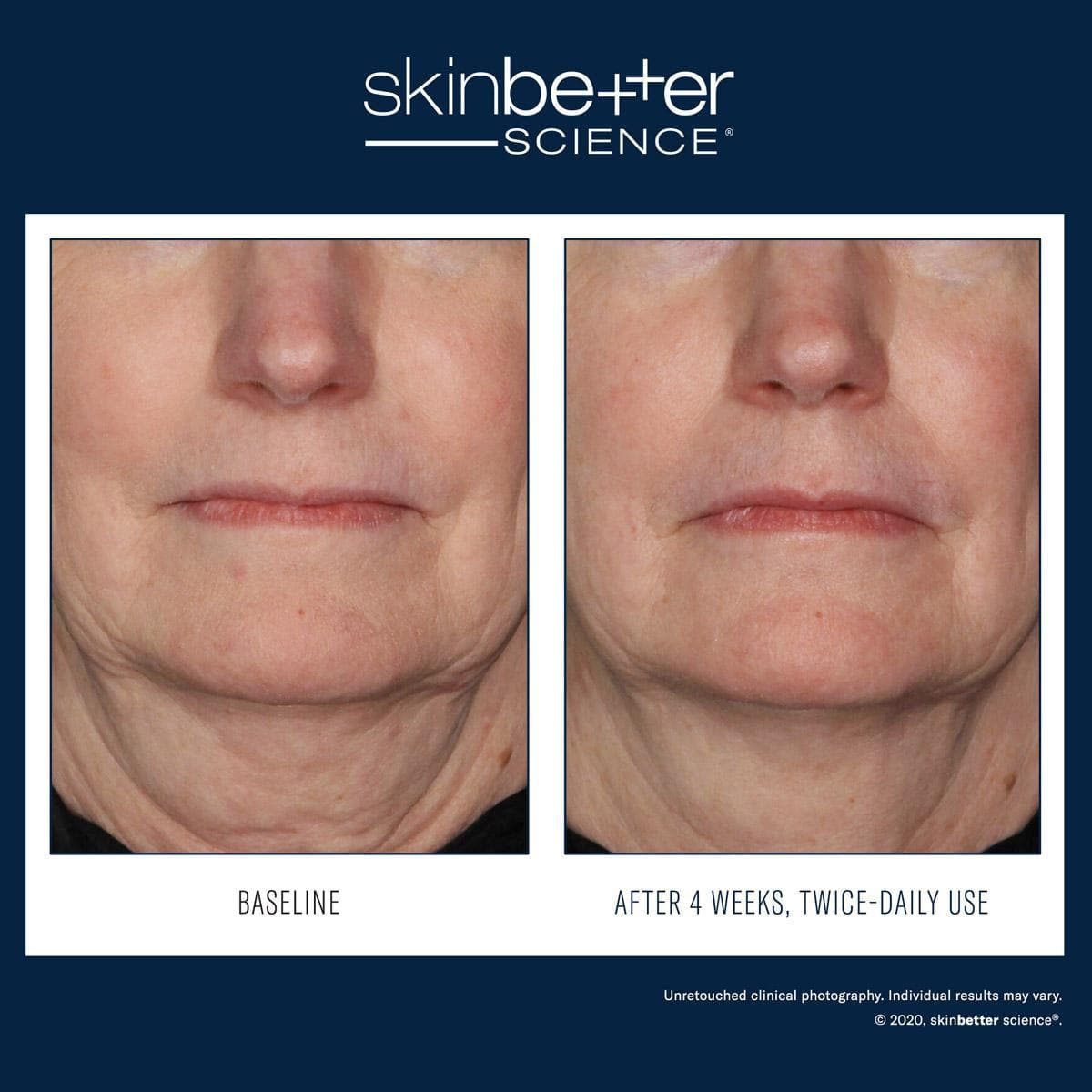 Skinbetter Science - Interfuse Treatment Cream Face & Neck - Shopthatapp.ca
