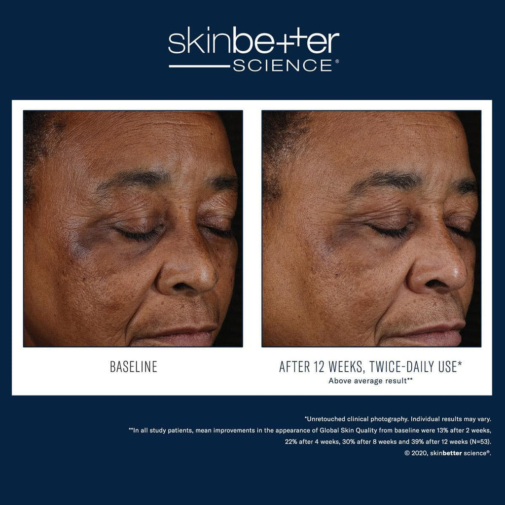 Skinbetter Science - Mystro Active Balance Serum - Shopthatapp.ca