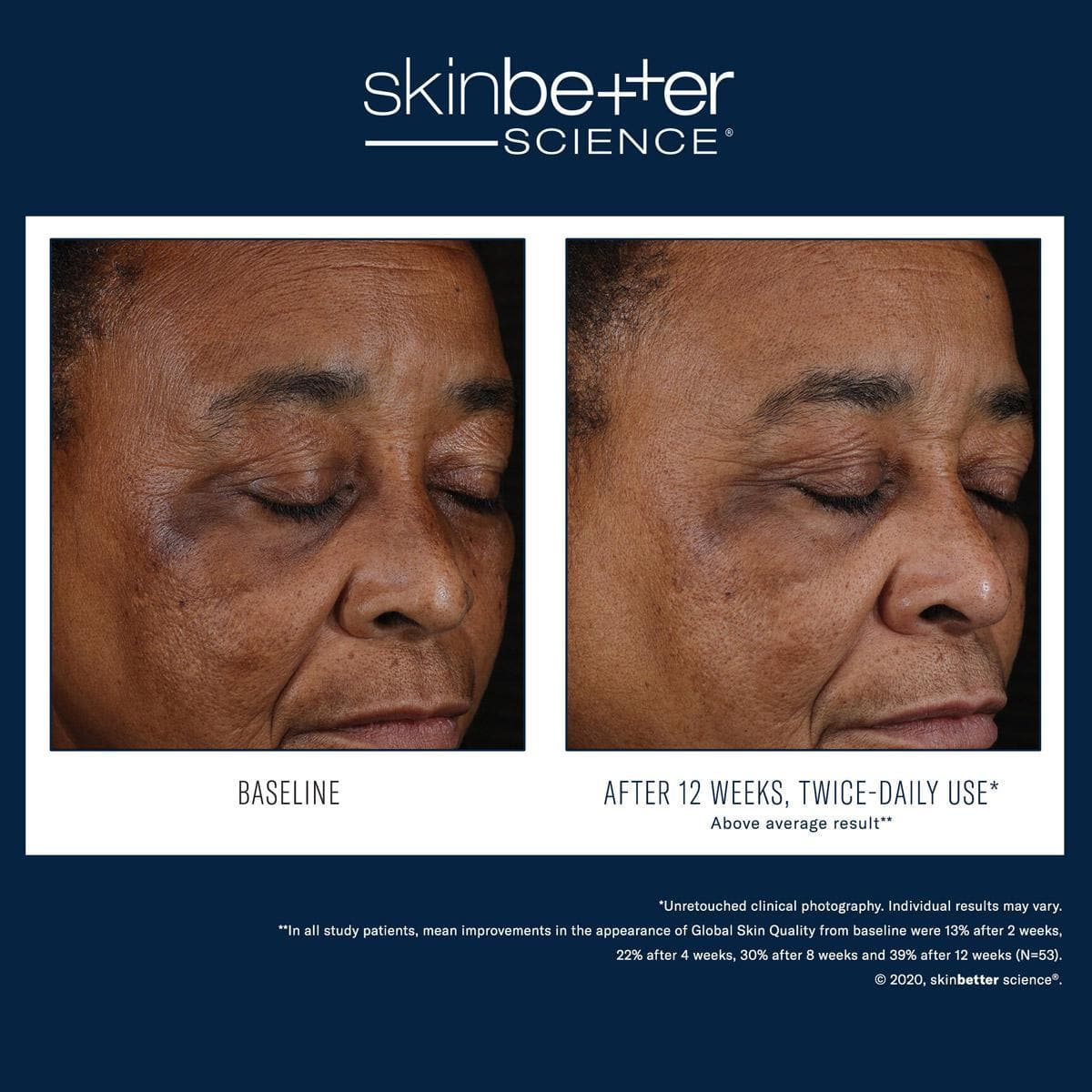 Skinbetter Science - Mystro Active Balance Serum - Shopthatapp.ca