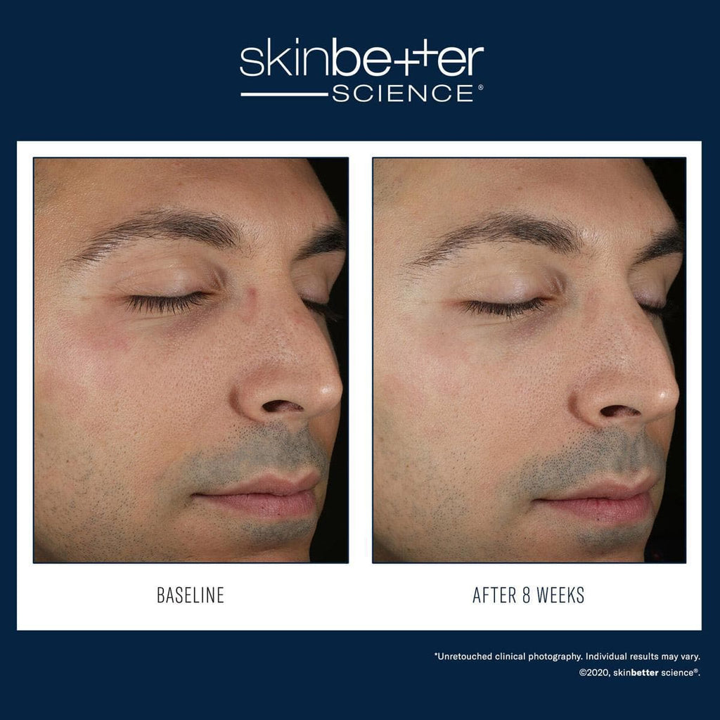 Skinbetter Science - Solo Hydrating Defense - Shopthatapp.ca