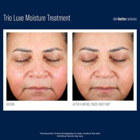 SkinBetter Science - Trio Luxe Moisture Treatment - Shopthatapp.ca