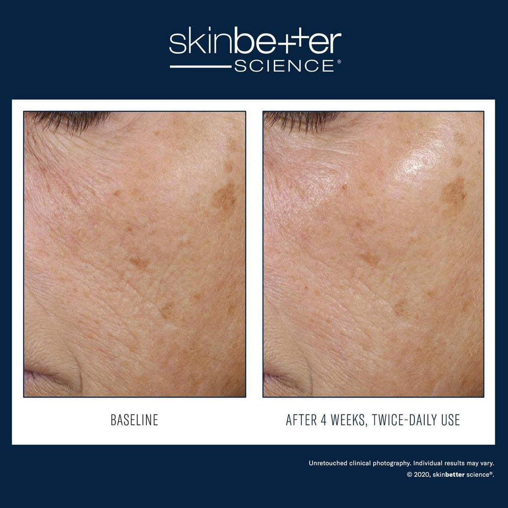 Skinbetter Science - Trio Rebalancing Moisture Treatment - Shopthatapp.ca