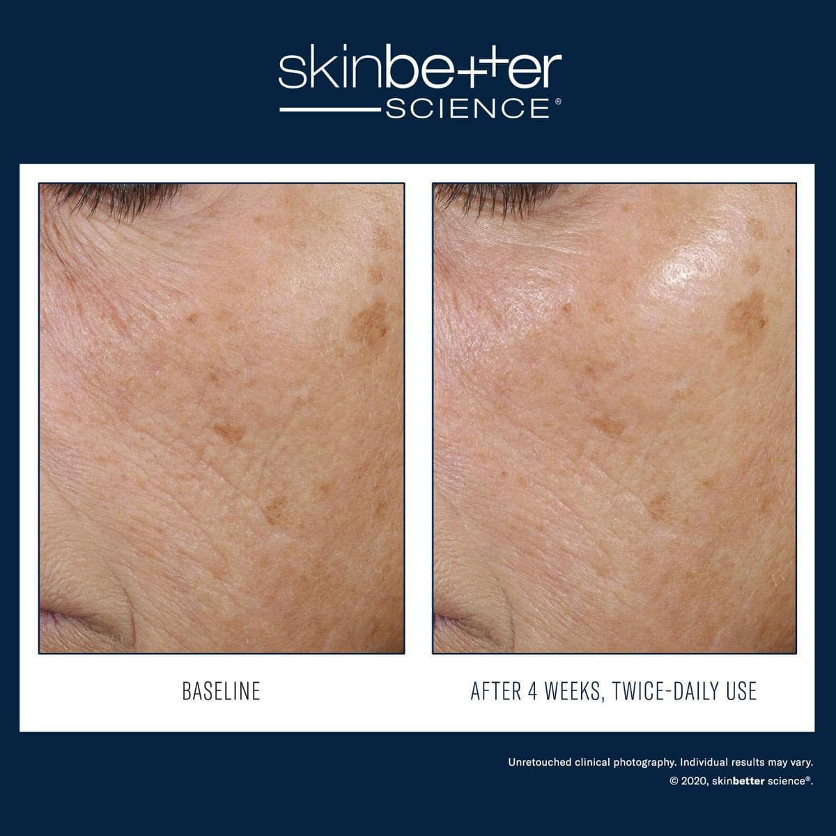 Skinbetter Science - Trio Rebalancing Moisture Treatment - Shopthatapp.ca