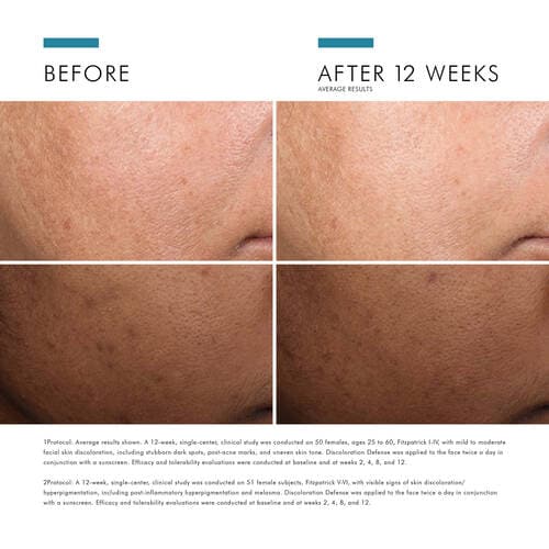 SkinCeuticals Discoloration Defense - Shopthatapp.ca