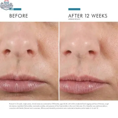 SkinCeuticals H.A. Intensifier serum bottle for enhanced hydration and skin firmness, displayed on a clean surface.
